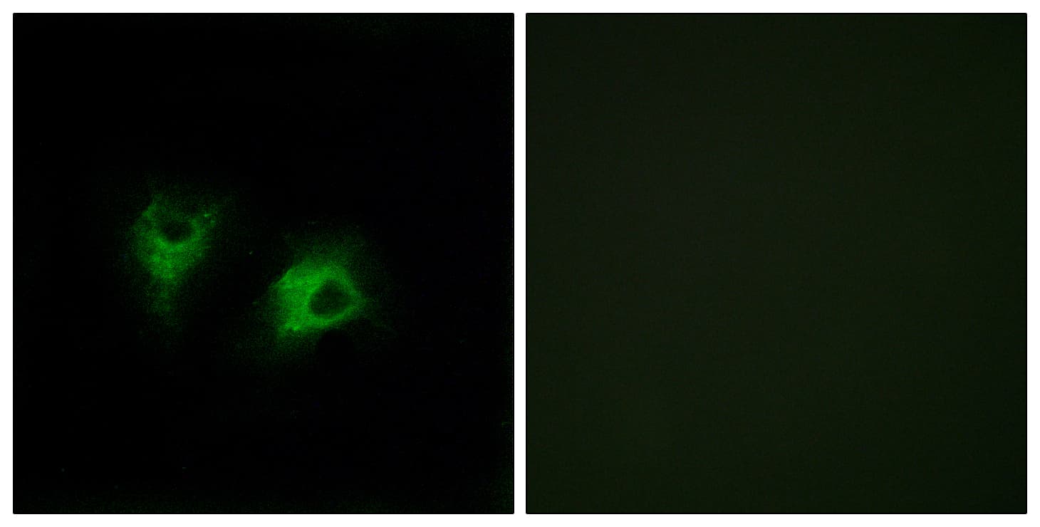 Polyclonal Rabbit anti-Human CELSR2 Antibody (aa2781-2830, IHC, IF)