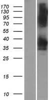 YDJC Protein (Over-Expression Lysate Myc-DDK (Flag))