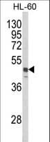 Polyclonal Rabbit anti-Human SNX6 Antibody (WB)