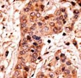 GUCY1A2 Antibody (aa699-732)