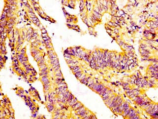 BMP12 / GDF7 Antibody