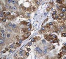 Polyclonal Rabbit anti-Human MAP3K3 / MEKK3 Antibody (IHC, WB)