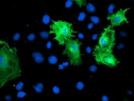 Monoclonal Mouse anti-Human CNN2 Antibody (clone OTI2B5, IHC, IF, WB)