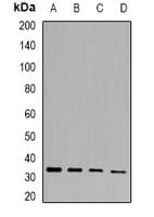 Polyclonal Rabbit anti-Human PHYHD1 Antibody (IF, WB)