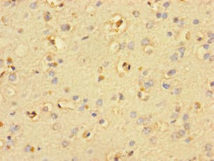 SMIM19 / C8orf40 Antibody