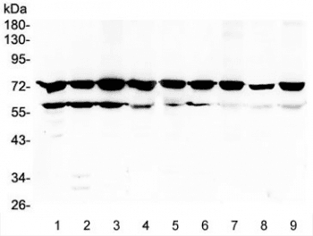 PRKCB / PKC-Beta Antibody