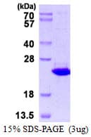 Human TXNDC12 Protein (Recombinant His)