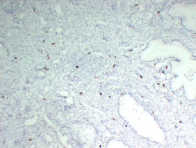 PathPlus™ Monoclonal Mouse anti-Human TPSAB1 / Mast Cell Tryptase Antibody (clone ABT-MCT, IHC)