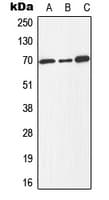 E2F1 Antibody (phospho-Thr433)