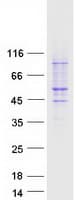 Human PAFAH1B1 / LIS1 Protein (Recombinant Myc-DDK (Flag))