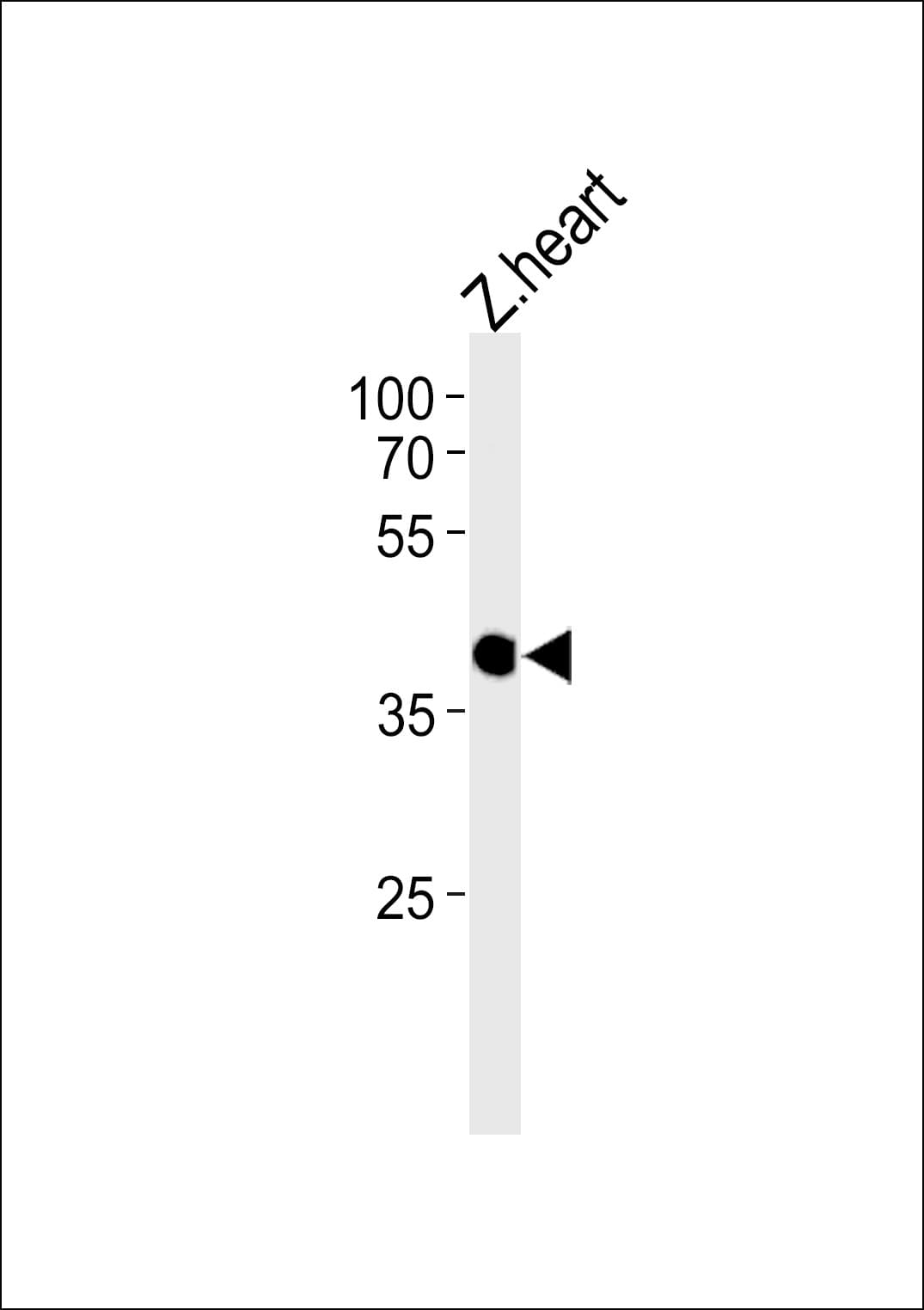CCDC89 Antibody (aa265-293)