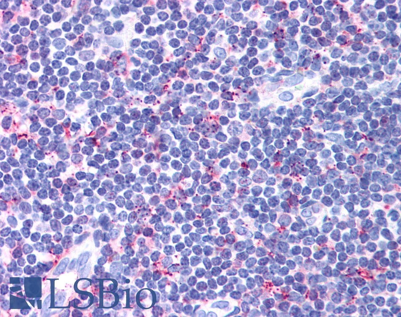 PathPlus™ CCR4 Antibody (Extracellular Domain)