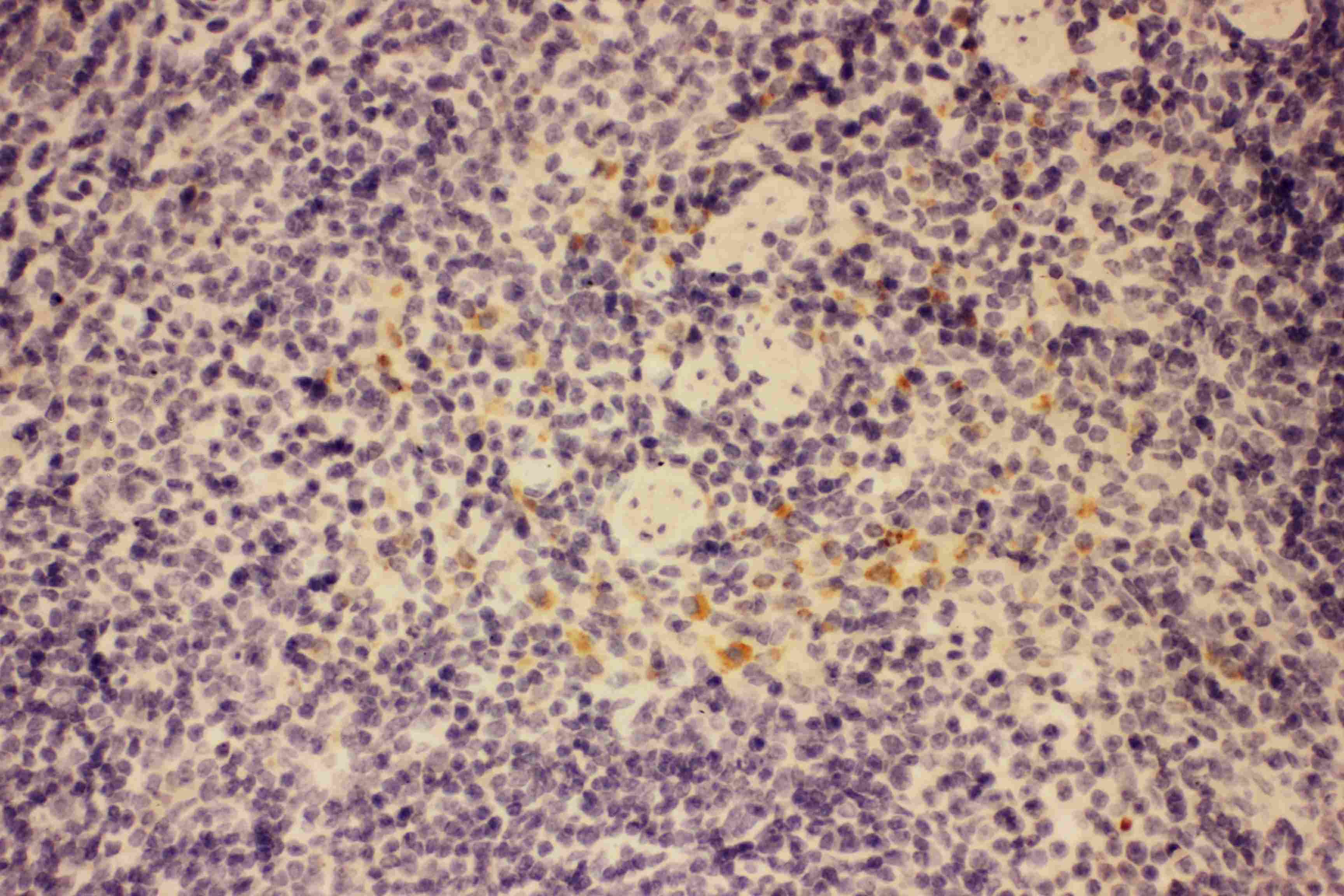 CSF2 / GM-CSF Antibody (aa18-141)