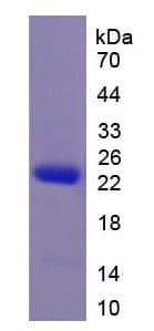 Rhesus monkey IL-10 Protein (Recombinant His-GST, N-terminus)