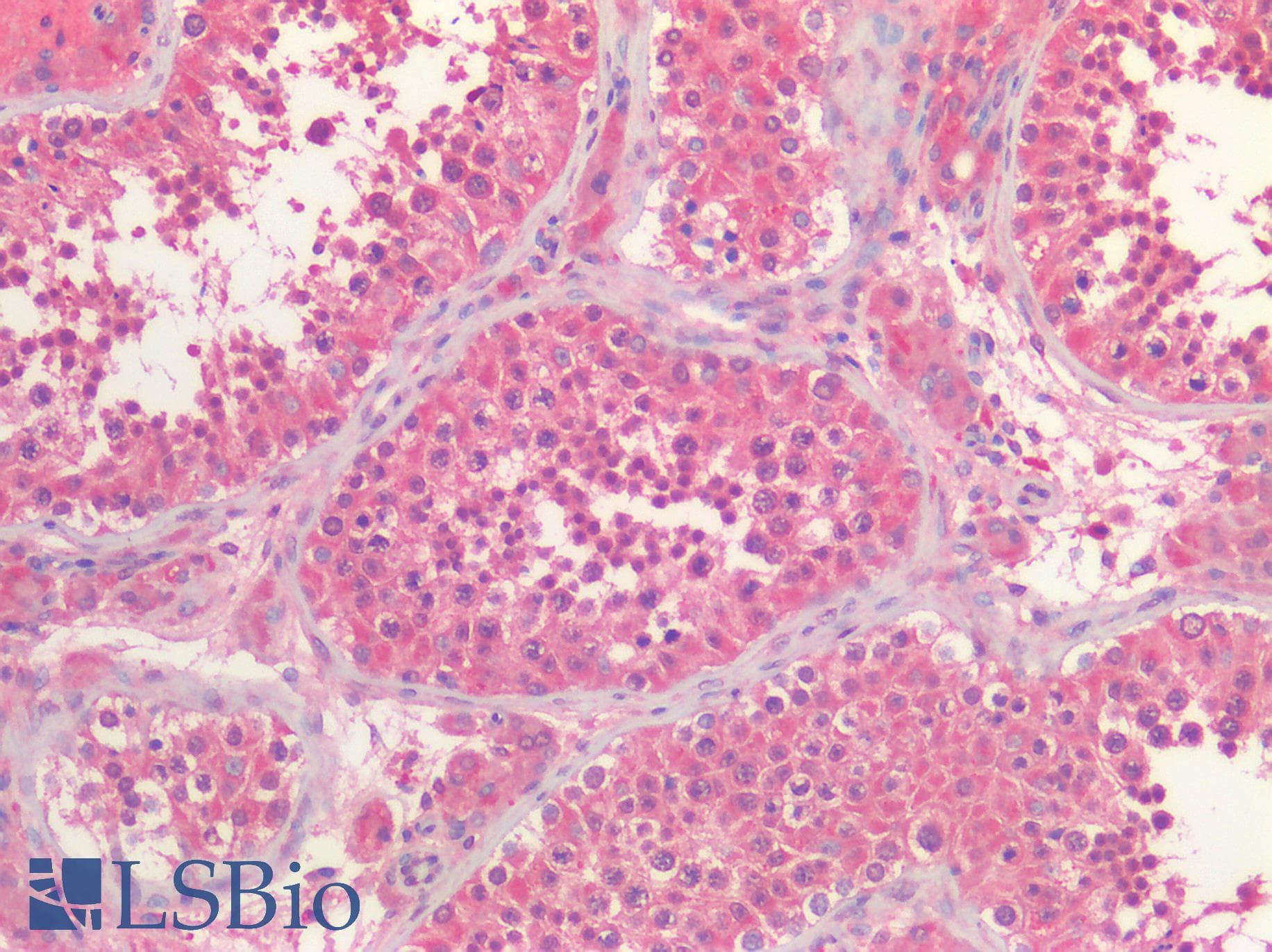 IHC-plus™ Polyclonal Rabbit anti-Human HDAC6 Antibody (IHC)