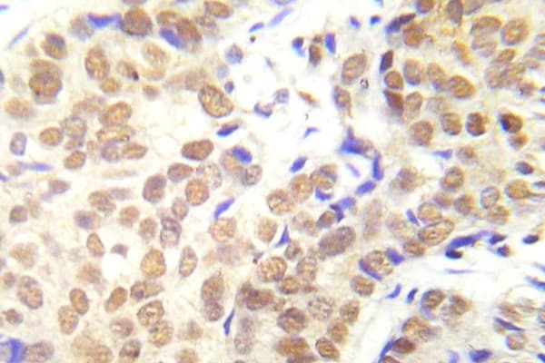 Polyclonal Rabbit anti-Human HDAC1 Antibody (phospho-Ser421/423, IHC)