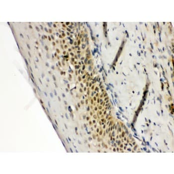 Polyclonal Rabbit anti-Human RAG2 / RAG-2 Antibody (aa498-527, IHC, WB)