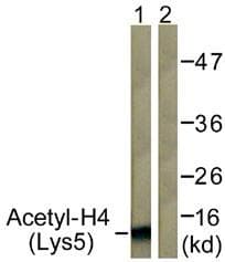 Polyclonal Rabbit anti-Human Histone H4 Antibody (Acetyl-Lys5, IHC, IF, WB)