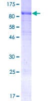 Human SOCS6 / SOCS-6 Protein (Recombinant GST)