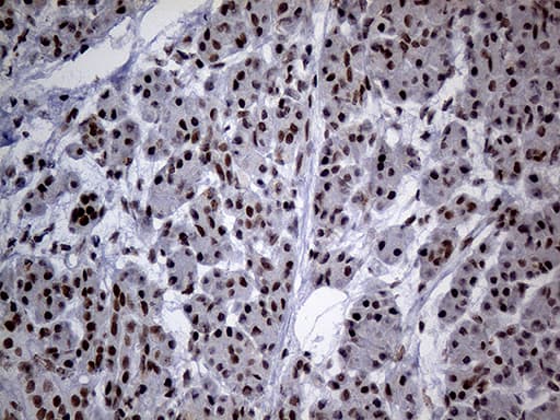 Monoclonal Mouse anti-Human SMC1A / SMC1 Antibody (clone OTI2D12, Carrier-free, aa889-1016, IHC, WB)