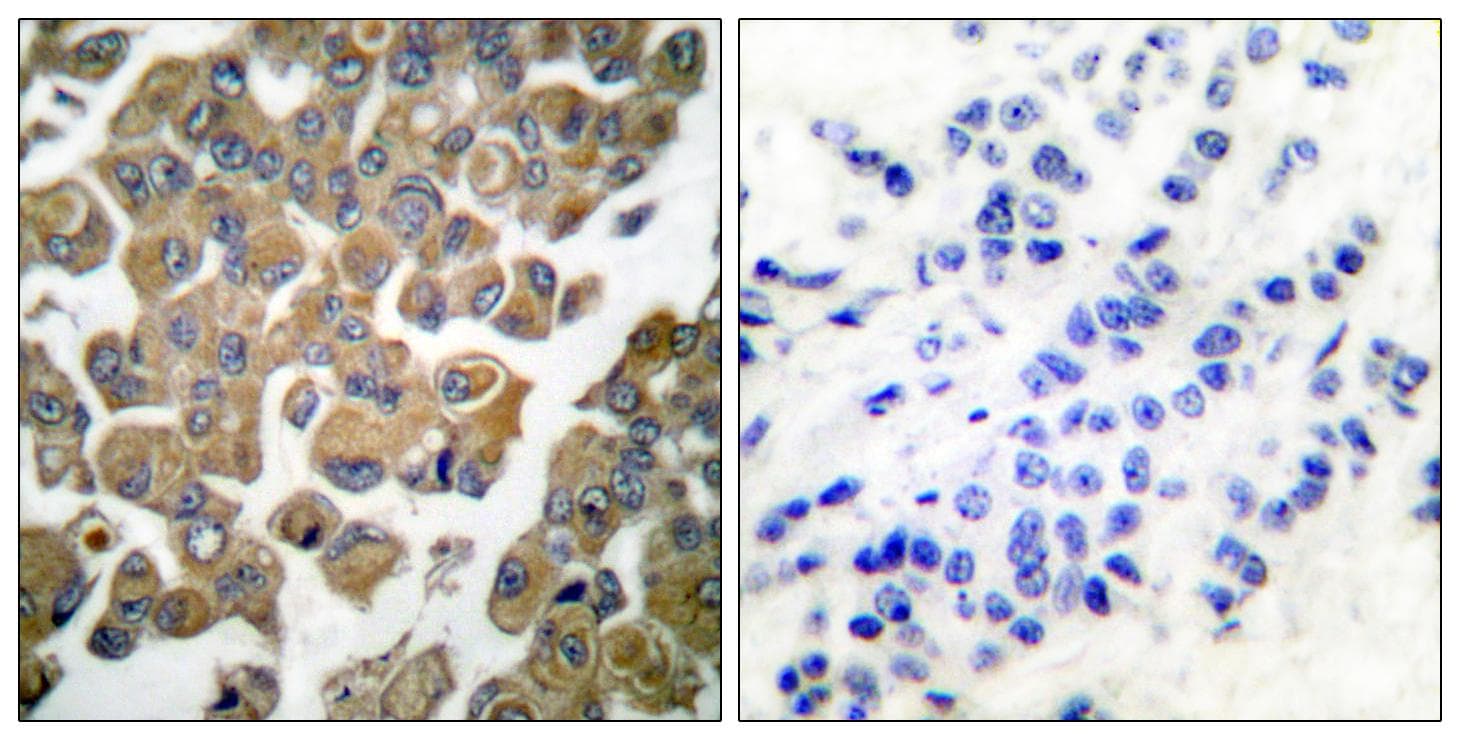 Polyclonal Rabbit anti-Human SYK Antibody (p525, IHC, WB)