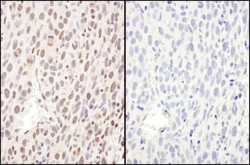 RELA / NFKB p65 Antibody (phospho-Ser468)