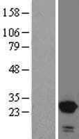 SNX10 Protein (Over-Expression Lysate Myc-DDK (Flag))