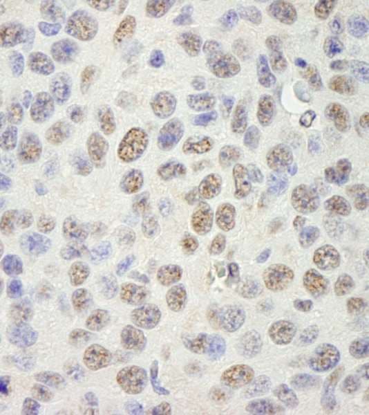 KHDRBS1 / SAM68 Antibody (aa1-50)