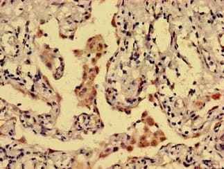 DRD1 / Dopamine Receptor D1 Antibody