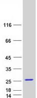 Human STMN1 / Stathmin / LAG Protein (Recombinant Myc-DDK (Flag))