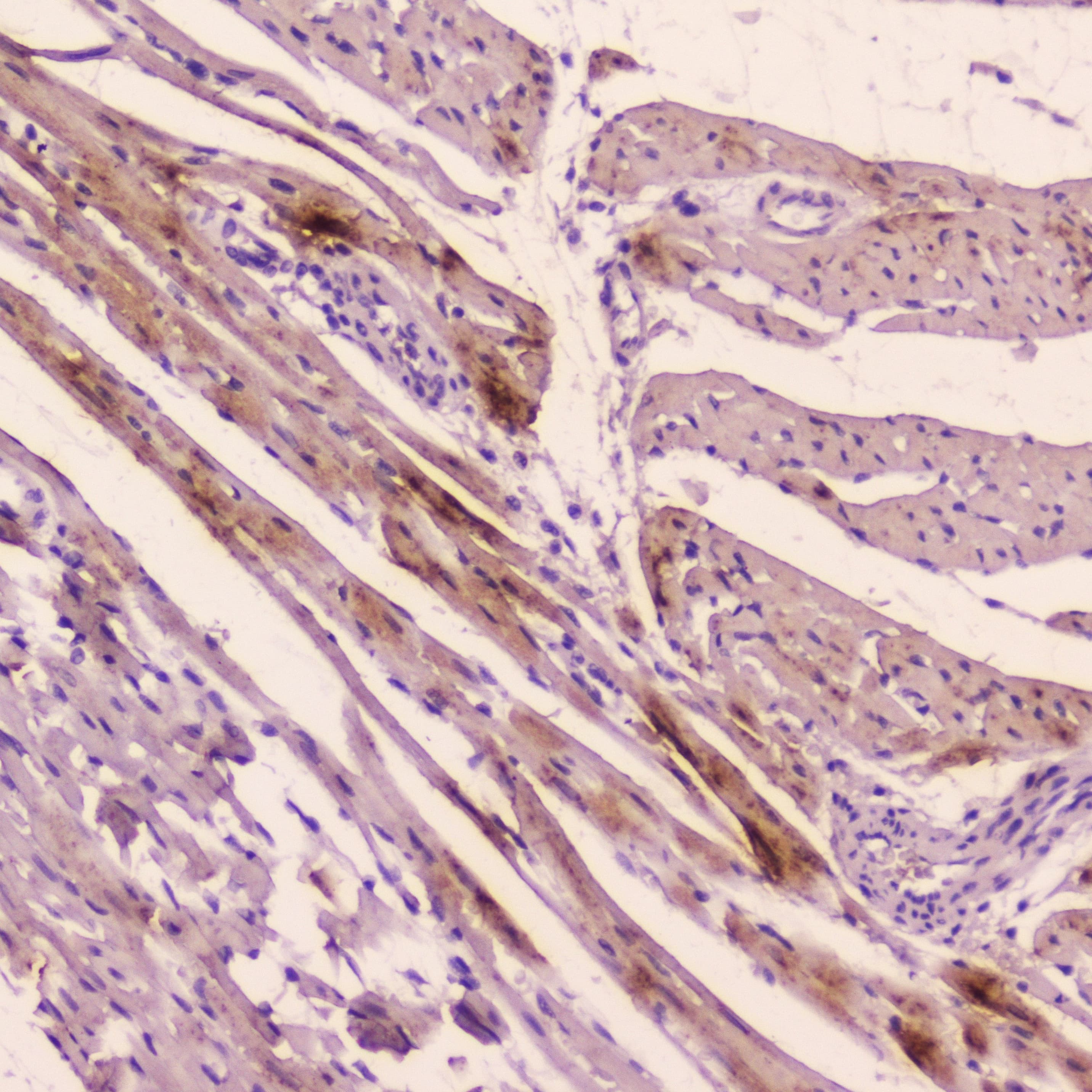 NPPA / ANP Antibody