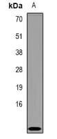 Polyclonal Rabbit anti-Human CRIP1 Antibody (WB)