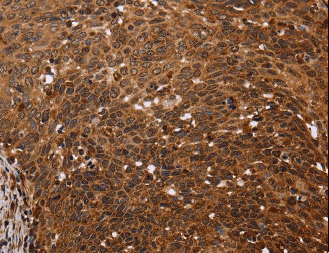 FANCF Antibody