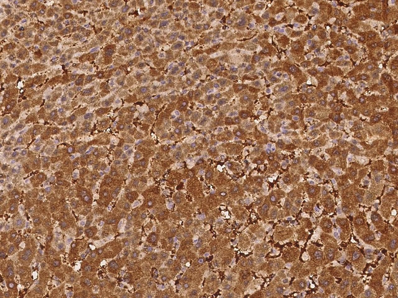 PGBD4 Antibody