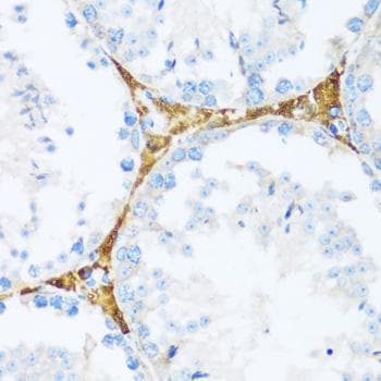 Polyclonal Rabbit anti-Human KIAA1811 / BRSK1 Antibody (IHC)