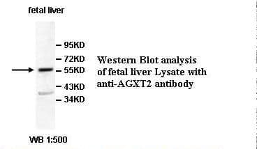 AGXT2 Antibody (Internal)