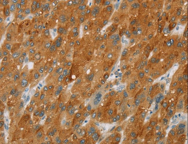 CYP2E1 Antibody