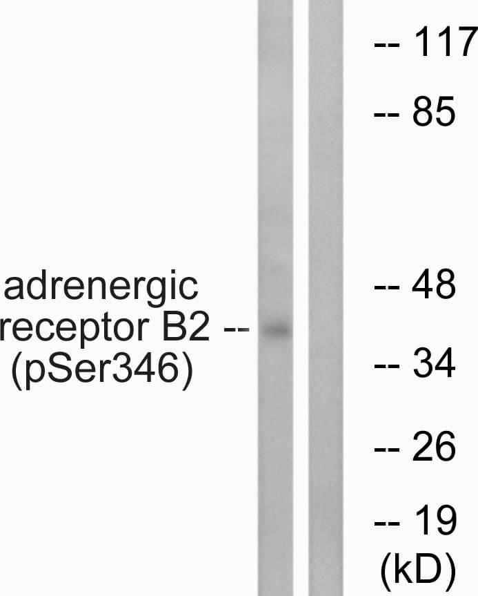 ADRB2 Antibody (phospho-Ser346)