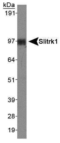 SLITRK1 Antibody