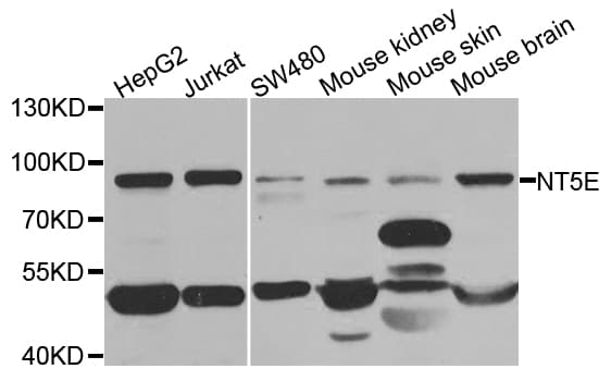 IHC-plus™ Polyclonal Rabbit anti-Human NT5E / eNT / CD73 Antibody (IHC, IF, WB)