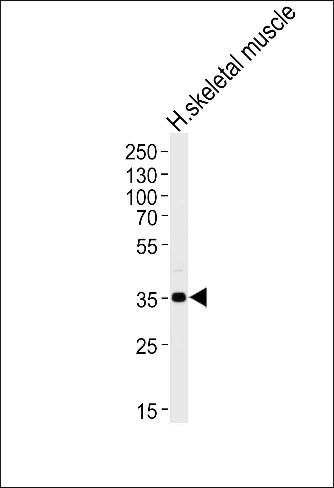PPP1R3B Antibody (aa205-231)