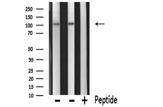 Polyclonal Rabbit anti-Human PKN1 Antibody (IF, WB)