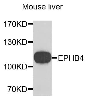 EPHB4 / EPH Receptor B4 Antibody