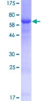 Human WDR89 Protein (Recombinant GST)