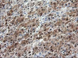 ACY1 / Aminoacylase 1 Antibody (clone OTI2D3)