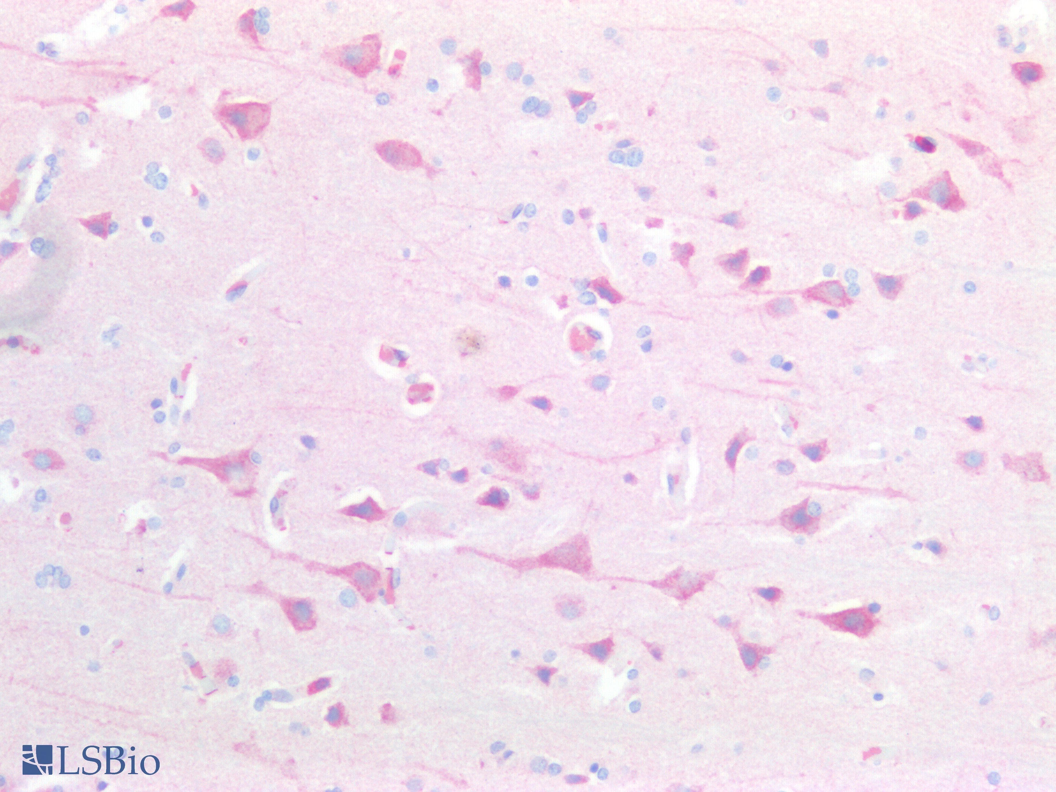 TNFRSF21 / DR6 Antibody (aa406-605)