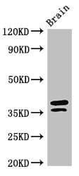 Polyclonal Rabbit anti-Human MAPRE2 / EB2 Antibody (IF, WB)