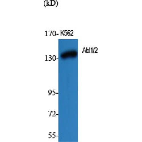 Polyclonal Rabbit anti-Human ABL Antibody (380-460 aa, IHC, WB)