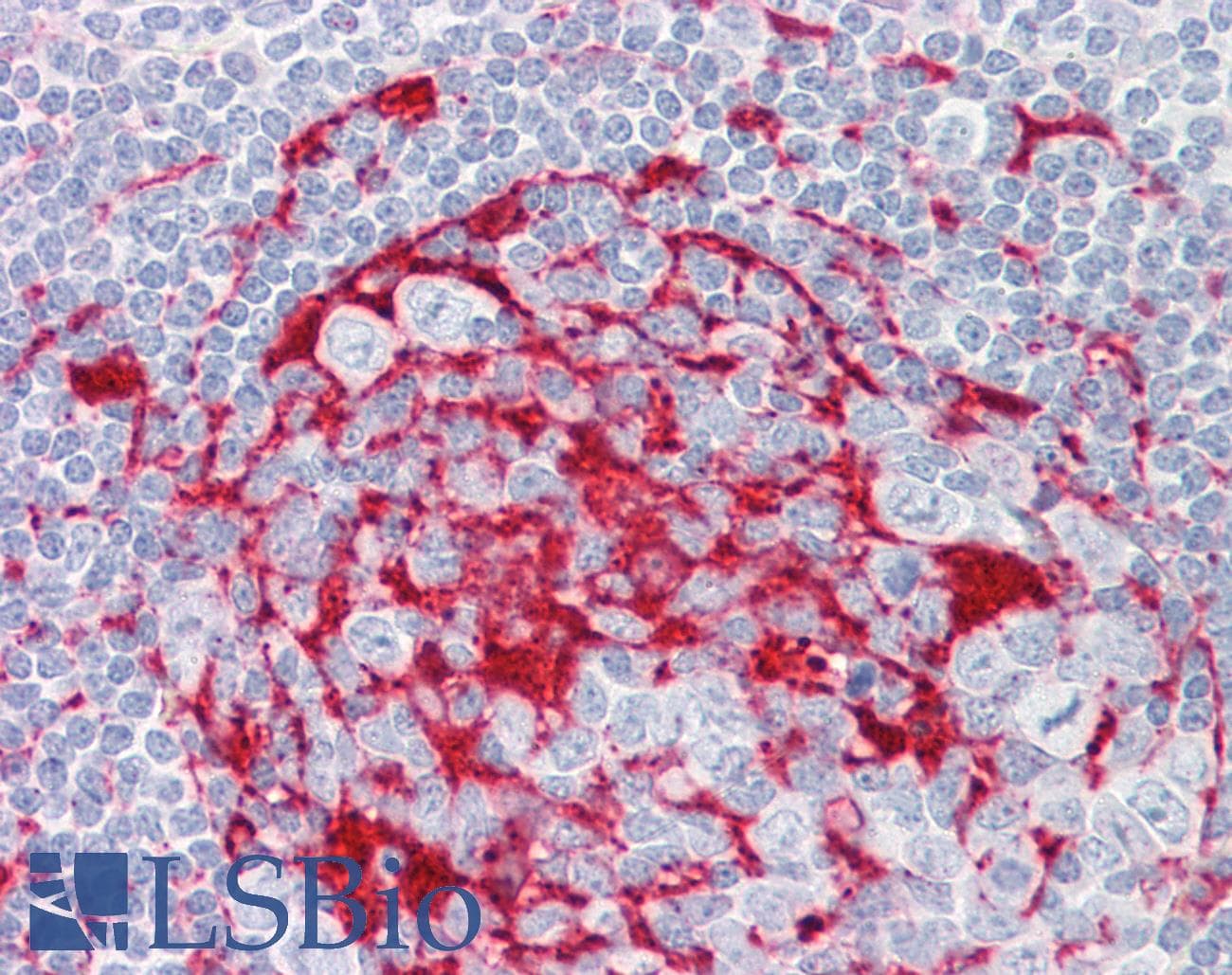 IHC-plus™ Polyclonal Rabbit anti-Human LRAT Antibody (aa111-160, IHC, IF, WB)