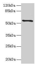 Polyclonal Rabbit anti-Human TMEM161A Antibody (IHC, WB)